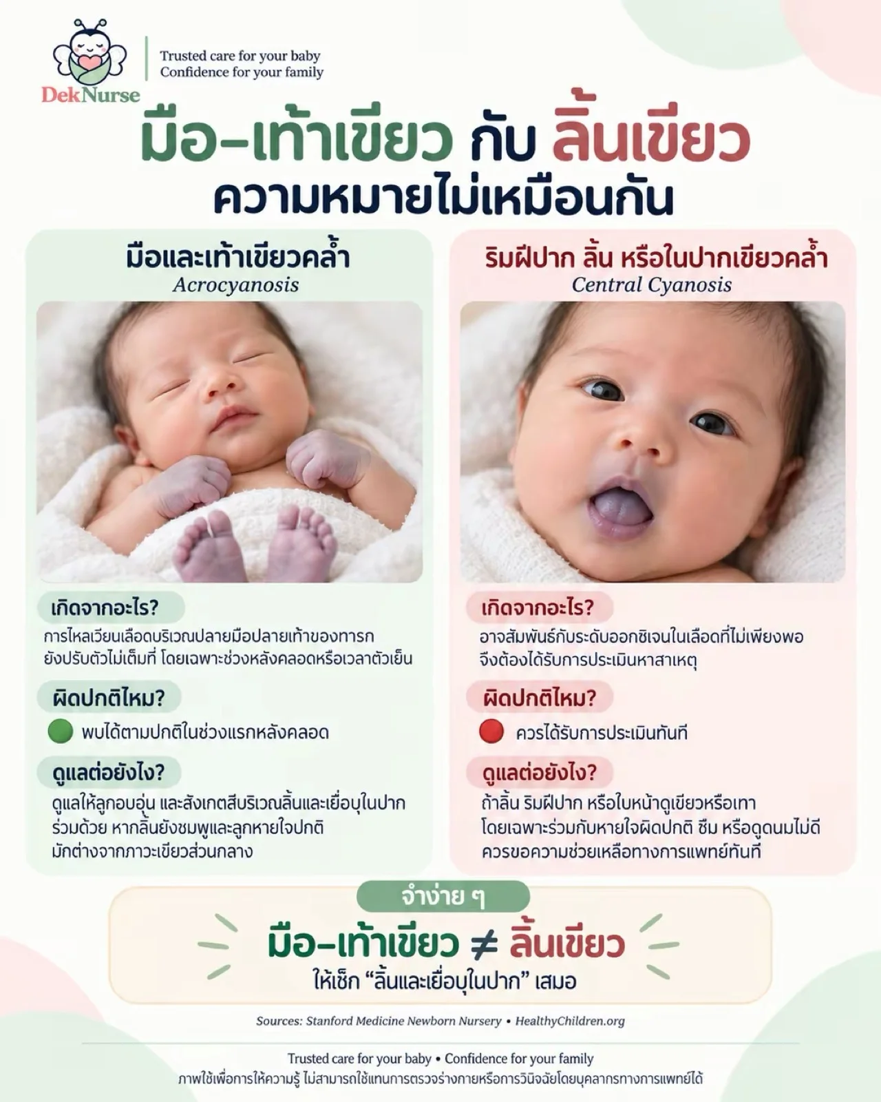 ภาพประกอบ: แผ่นความรู้เปรียบเทียบมือและเท้าเขียวคล้ำซึ่งพบได้ตามปกติในช่วงแรกหลังคลอด กับริมฝีปากหรือลิ้นเขียวคล้ำซึ่งควรได้รับการประเมินทันที