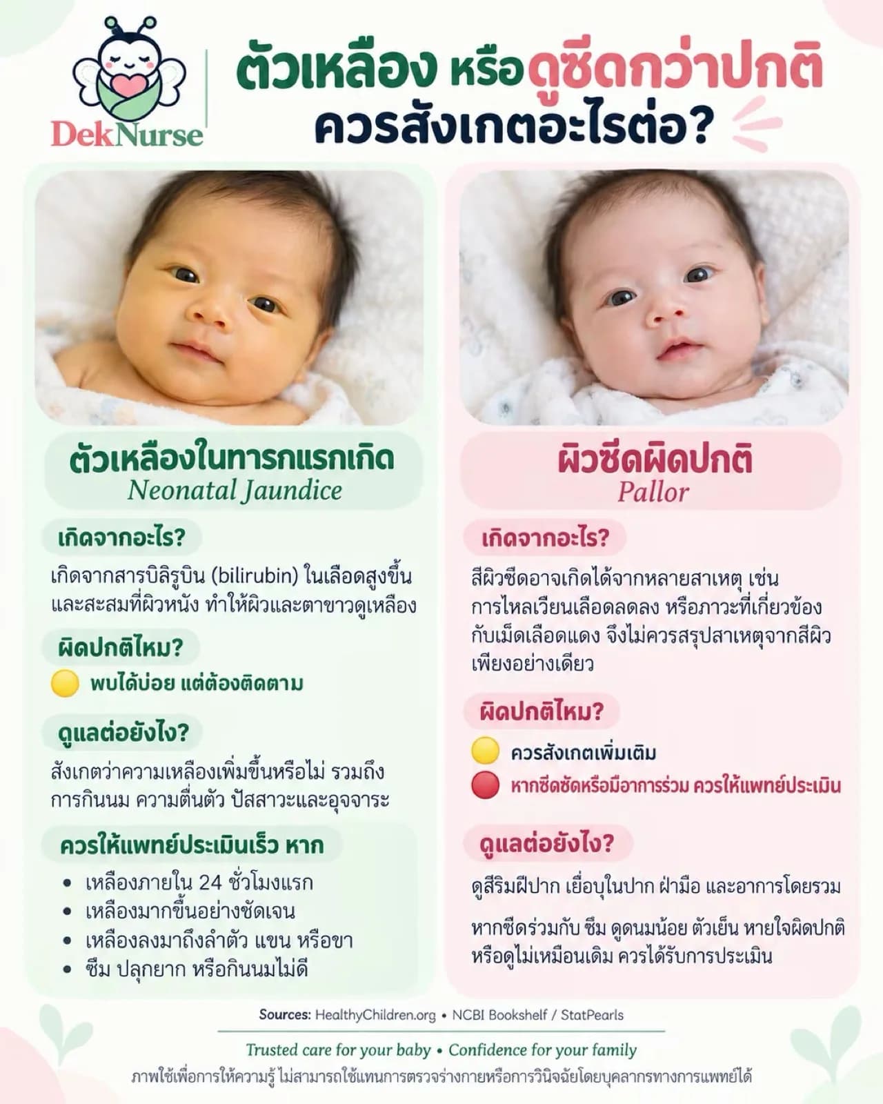 ภาพประกอบ: แผ่นความรู้เปรียบเทียบภาวะตัวเหลืองในทารกแรกเกิดกับผิวซีดผิดปกติ อธิบายสาเหตุ วิธีสังเกต และเกณฑ์ที่ควรให้แพทย์ประเมินของแต่ละแบบ