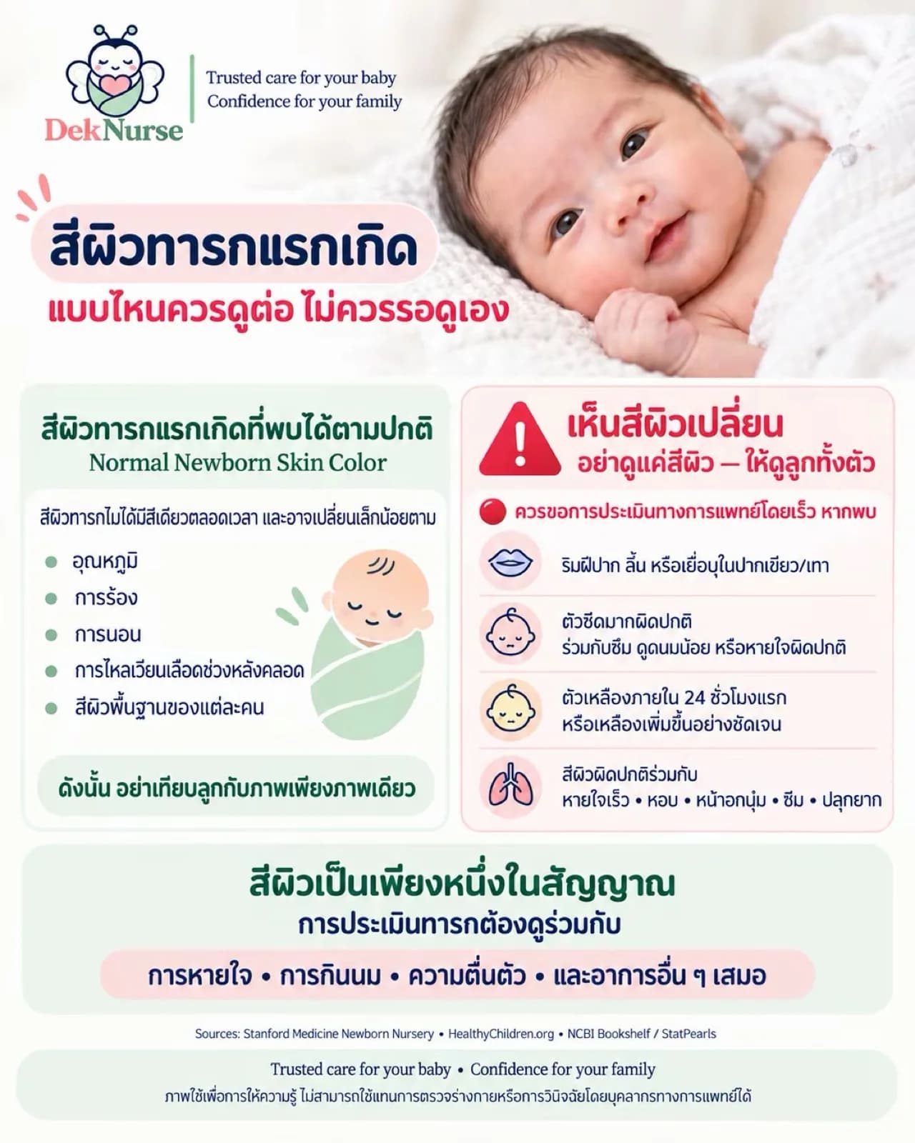 ภาพประกอบ: แผ่นความรู้เปรียบเทียบสีผิวทารกแรกเกิดที่พบได้ตามปกติ กับสัญญาณที่ควรขอการประเมินทางการแพทย์โดยเร็ว เช่น ริมฝีปากหรือลิ้นเขียว ตัวซีดมาก ตัวเหลืองใน 24 ชั่วโมงแรก และสีผิวผิดปกติร่วมกับหายใจเร็ว